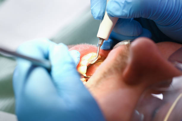 Best Urgent Dental Care for Toothache in Pecan Grove, TX
