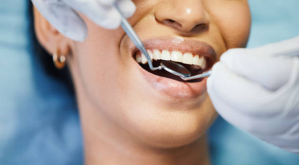 Best Emergency Root Canal Treatment in Pecan Grove, TX